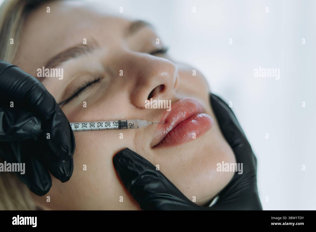 Precision Lip Enhancement: Professionelle injizierbare Behandlung im Gange. Hochwertige Fotos Stockfoto