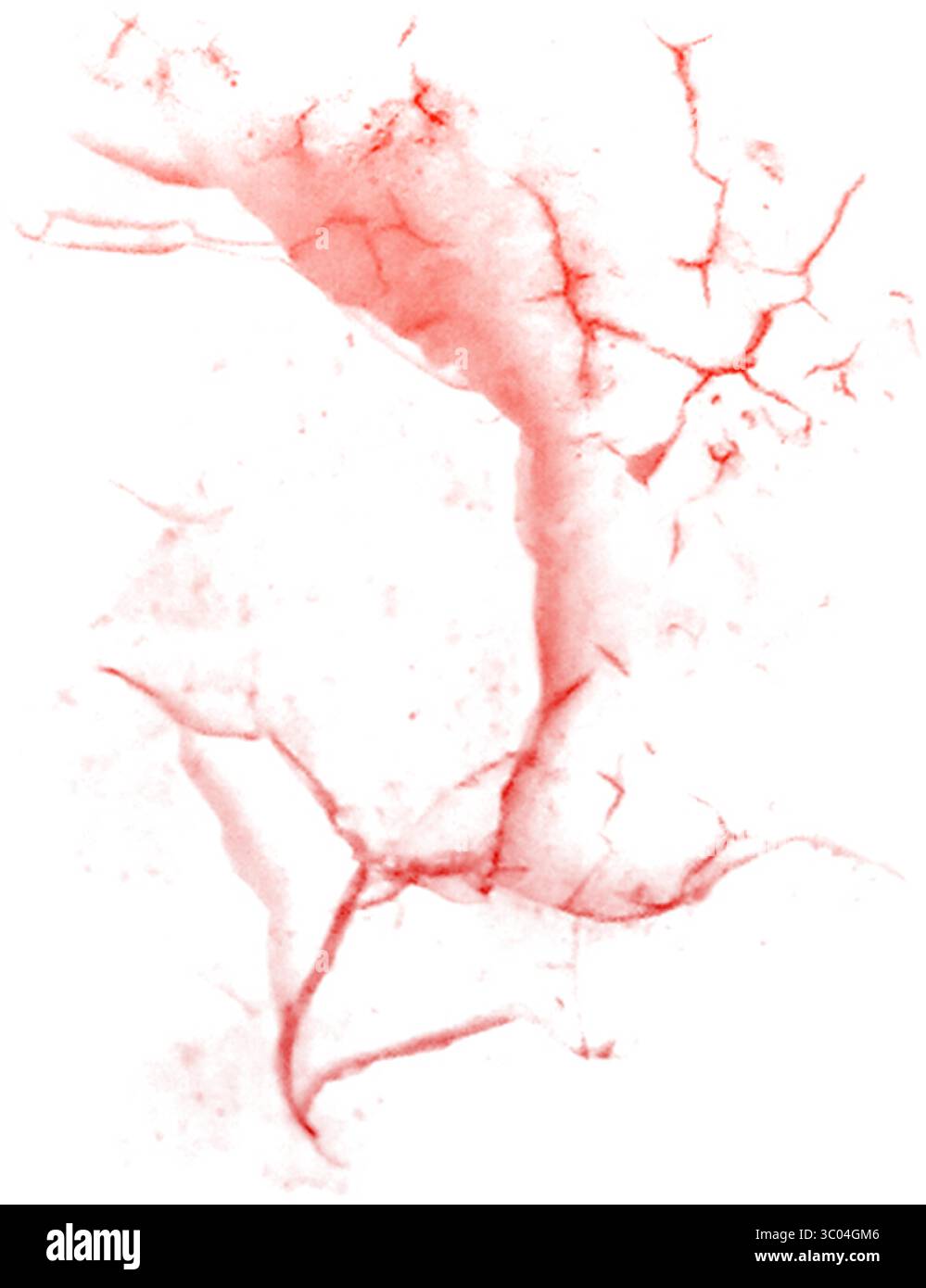 Ein detailliertes mikroskopisches Bild, das das komplizierte Netzwerk roter verzweigter Blutgefäße in einem blassen, strukturierten biologischen Gewebe zeigt. Stock Vektor