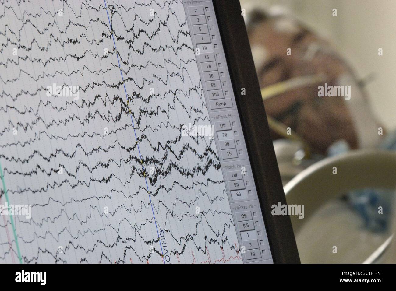 Januar 2005 - Toronto, ON, KANADA - Ein Laptop-Monitor zeigt die EEG-Werte der Gehirnaktivität eines Patienten in der Critical Care Unit (CRCU) des Sunnybrook and Women's College Hospital an. (Kreditbild: Rick Madonik/Minneapolis Star Tribune/TNS via ZUMA Wire) Stockfoto