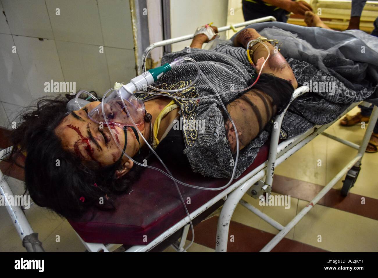Juni 2019 – Kashmir, J&K, Indien – (HINWEIS DER REDAKTION: Bild enthält Grafikinhalte.) Eine verletzte Frau wird in einem örtlichen Krankenhaus nach einem Busunfall in Srinagar behandelt. Elf Studenten, darunter neun Mädchen, wurden bei einem Unfall getötet, nachdem der Ausflugsbus, in dem sie unterwegs waren, in eine tiefe Schlucht am Peer KI Gali fiel, einem Bergpass an der historischen Mogul Road im Shopian District in Kaschmir. Sieben Menschen wurden bei dem Unfall verletzt und wurden in ein lokales Krankenhaus in Srinagar zur Behandlung gebracht, sagte der Beamte. (Kreditbild: © Saqib Majeed/SOPA Images via ZUMA Stockfoto