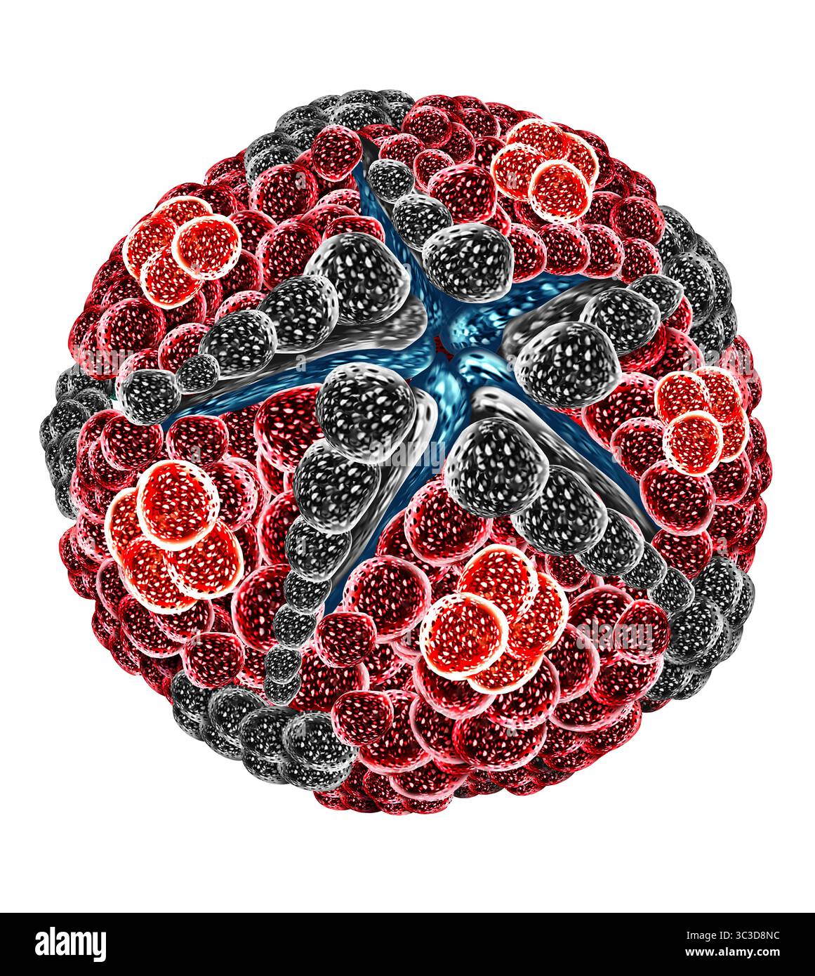 Chikungunya-Virus-Ausbruchskonzept als Moskito-übertragener Viruspathogen, der hohes Fieber verursacht, starke Gelenkschmerzen und andere grippeähnliche Symptome Stockfoto