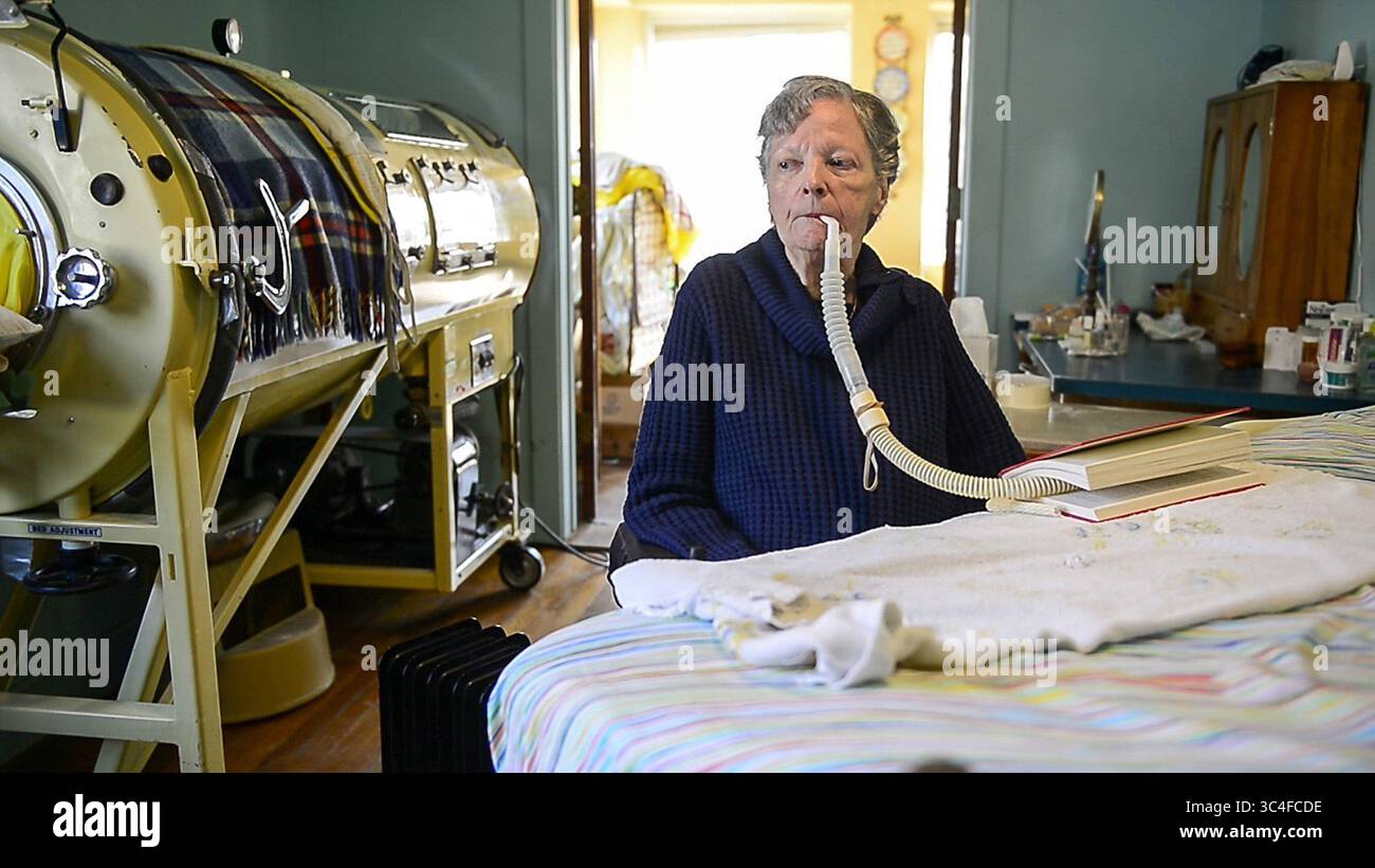 2. April 2018 – USA – Mona Randolph, 82, verwendet tagsüber ein Atemschutzgerät, um ihr beim Atmen zu helfen. Das moderne Gerät ist für sie nicht so bequem wie die 75 Jahre alte eiserne Lunge, da es Luft in ihre Lungen drückt, was „irritierend“ sein könnte. Mona bekam Polio, als sie 20 Jahre alt war, und litt seit ihren 40ern an einem Post-Polio-Syndrom (Bild: © Shelly Yang/TNS via ZUMA Wire) Stockfoto