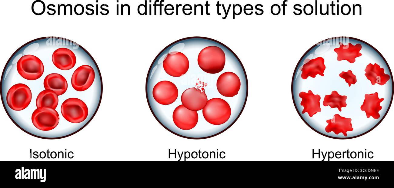 Osmose bei verschiedenen Arten von Solutionl. Erythrozyten in hypertonischer, hypotonischer und isotonischer Lösung. Detailliertes Vektorposter Stock Vektor