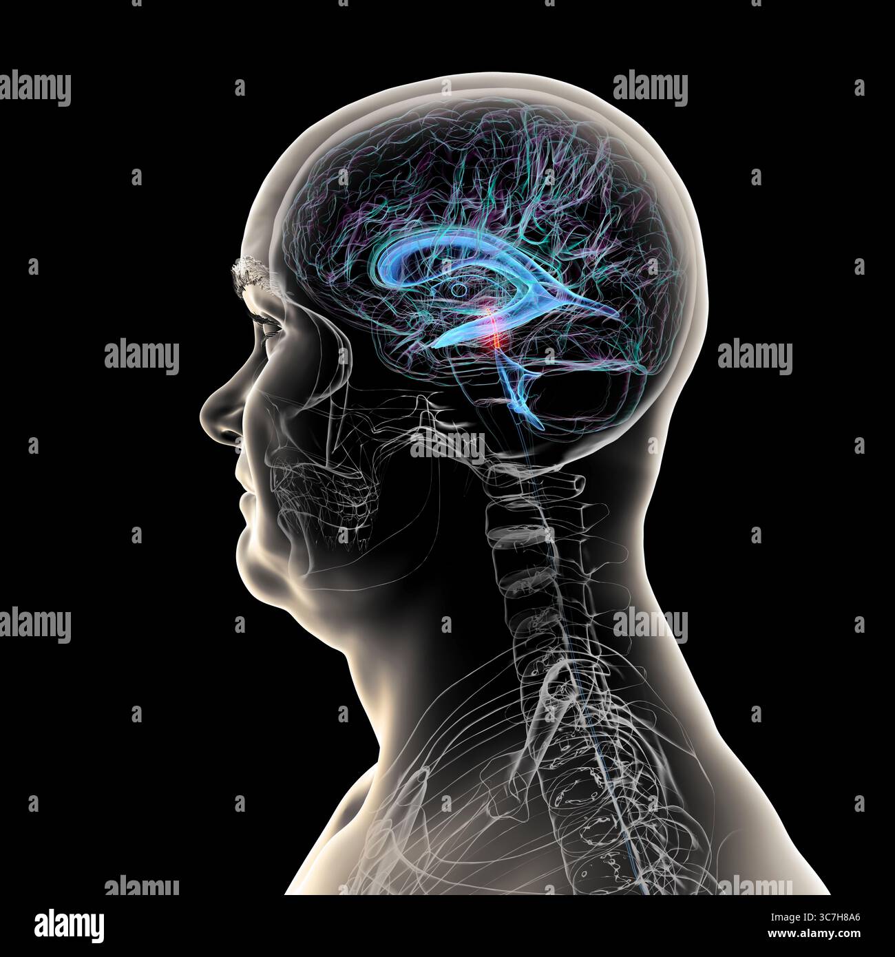 Abbildung des Gehirns mit hervorgehobenem Aquädukt (rot) und ventrikulärem System (blau), Darstellung des Liquorflusses. Stockfoto