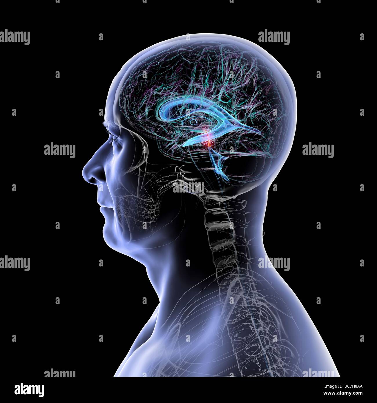 Abbildung des Gehirns mit hervorgehobenem Aquädukt (rot) und ventrikulärem System (blau), Darstellung des Liquorflusses. Stockfoto