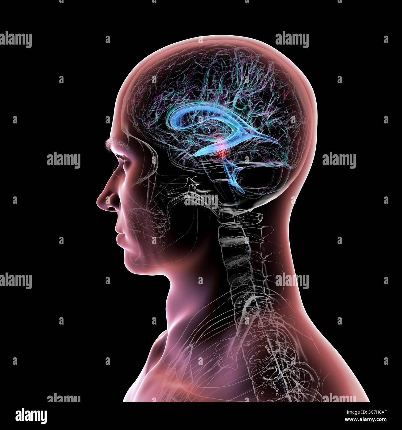Abbildung des Gehirns mit hervorgehobenem Aquädukt (rot) und ventrikulärem System (blau), Darstellung des Liquorflusses. Stockfoto