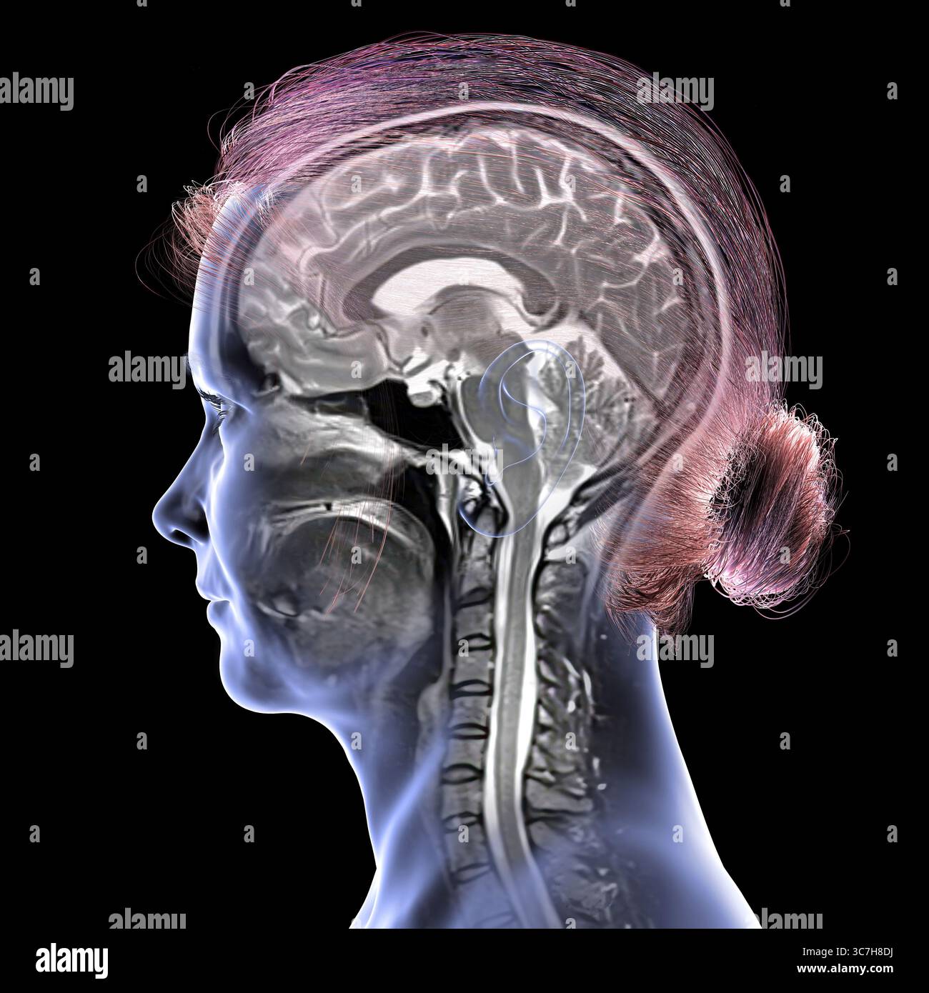 Abbildung einer farbigen Magnetresonanztomographie (MRT) des Gehirns und Halses, die die Anatomie des Zentralnervensystems und die Halswirbelsäule zeigt. Stockfoto