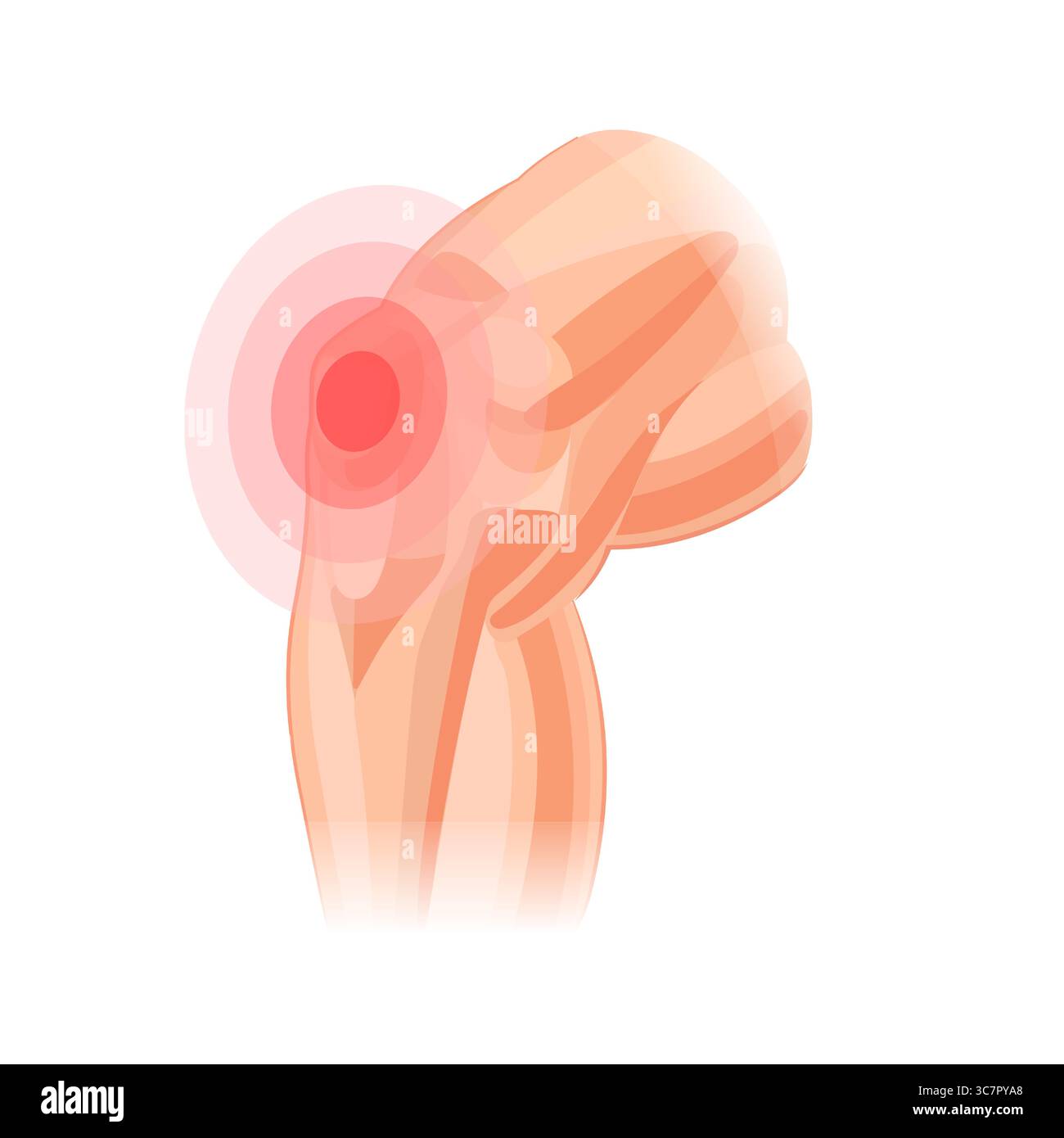 Das menschliche Knie schmerzt. Schmerzen im Knie. Arthritis. Menschliche Anatomie. Vektorillustration isoliert auf weißem Hintergrund Stock Vektor
