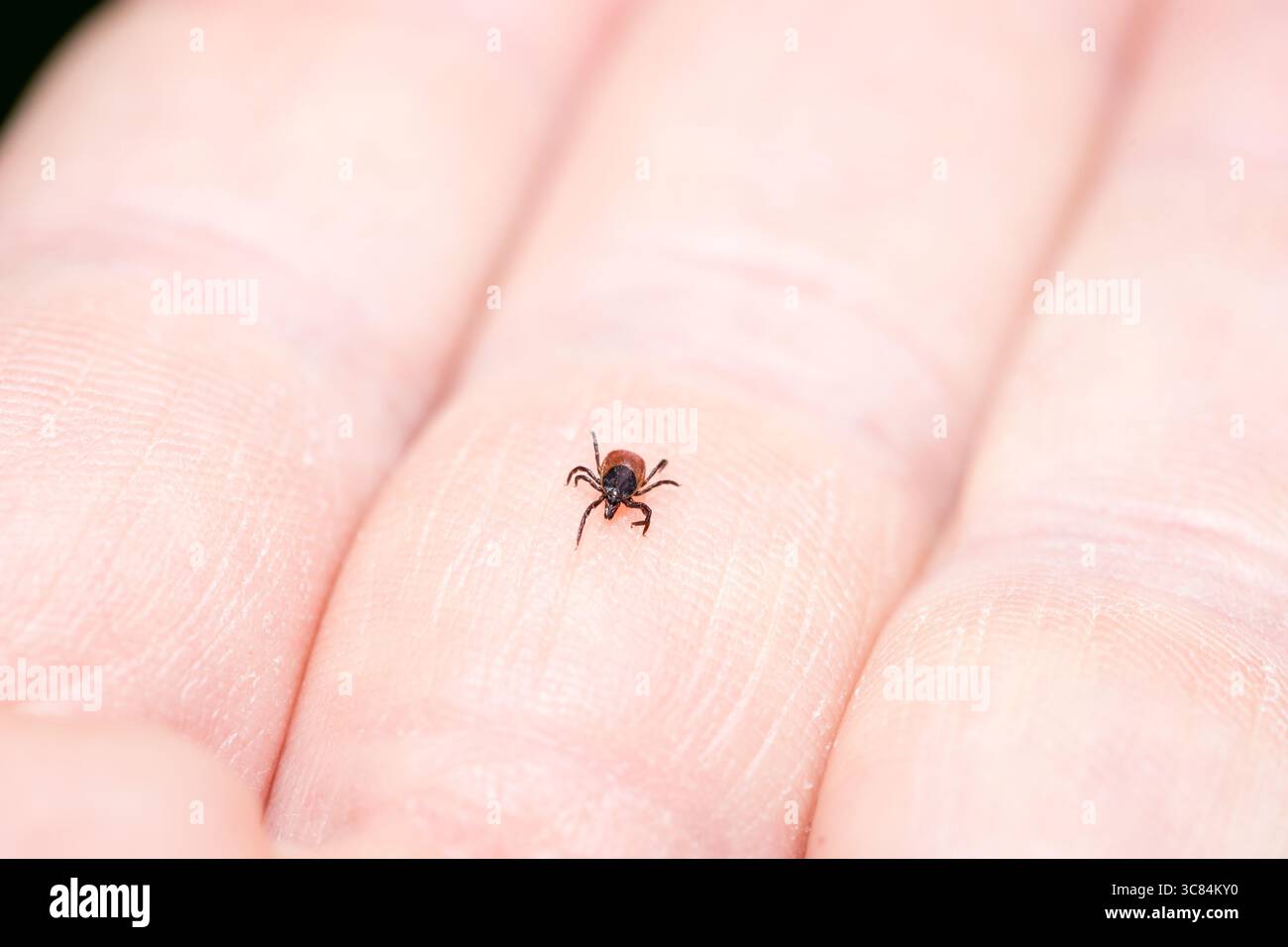 Häkchen (Icodes ricinus) krabbeln auf der menschlichen Hand Stockfoto