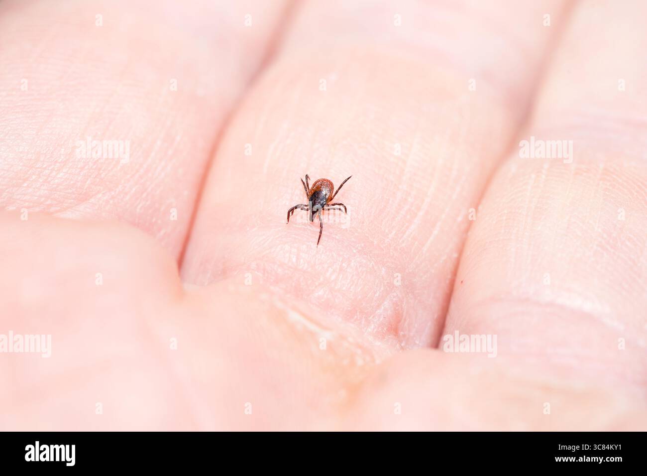 Häkchen (Icodes ricinus) krabbeln auf der menschlichen Hand Stockfoto
