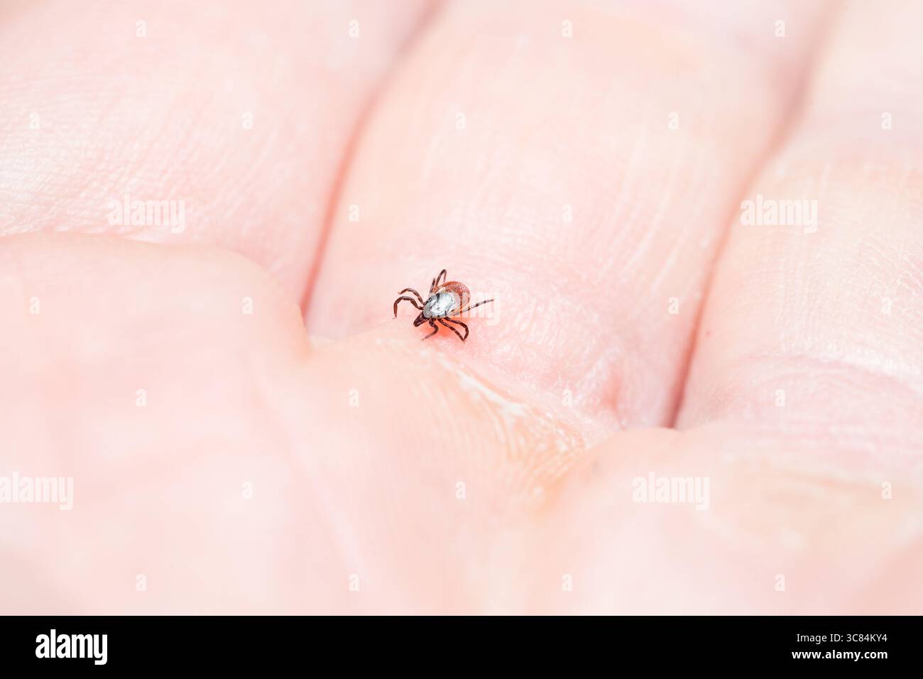 Häkchen (Icodes ricinus) krabbeln auf der menschlichen Hand Stockfoto