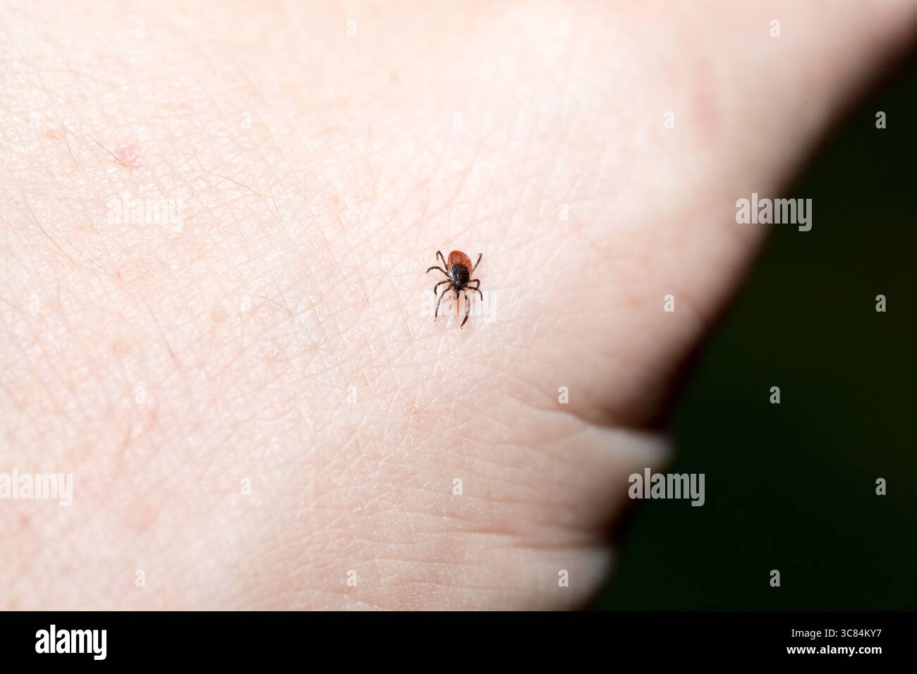 Häkchen (Icodes ricinus) krabbeln auf der menschlichen Hand Stockfoto