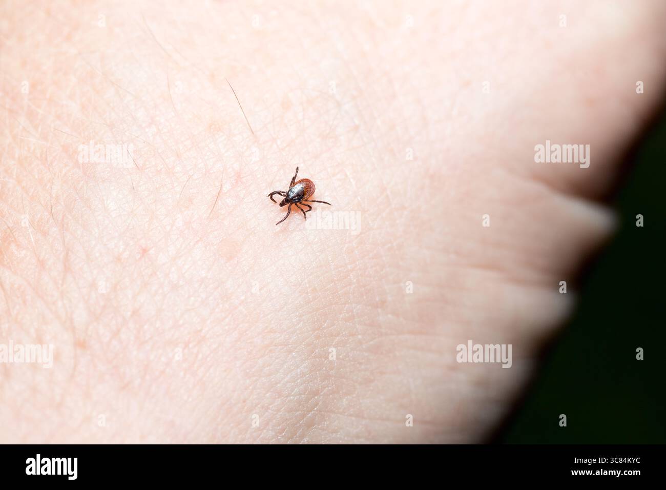 Häkchen (Icodes ricinus) krabbeln auf der menschlichen Hand Stockfoto