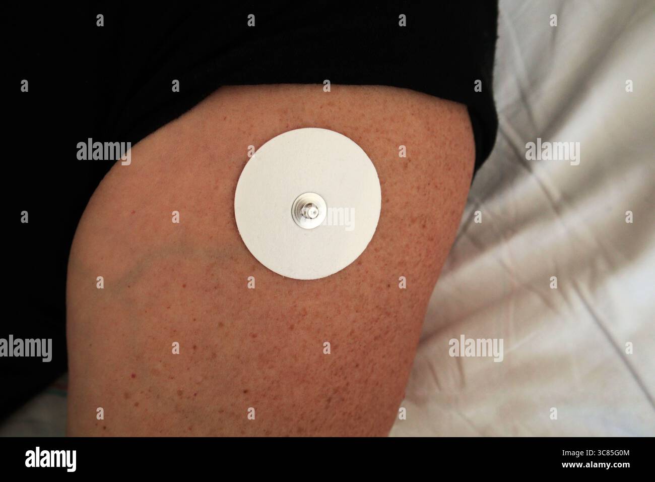 Elektrokardiographiegerät am Körper, Nahaufnahme des männlichen Arms Stockfoto