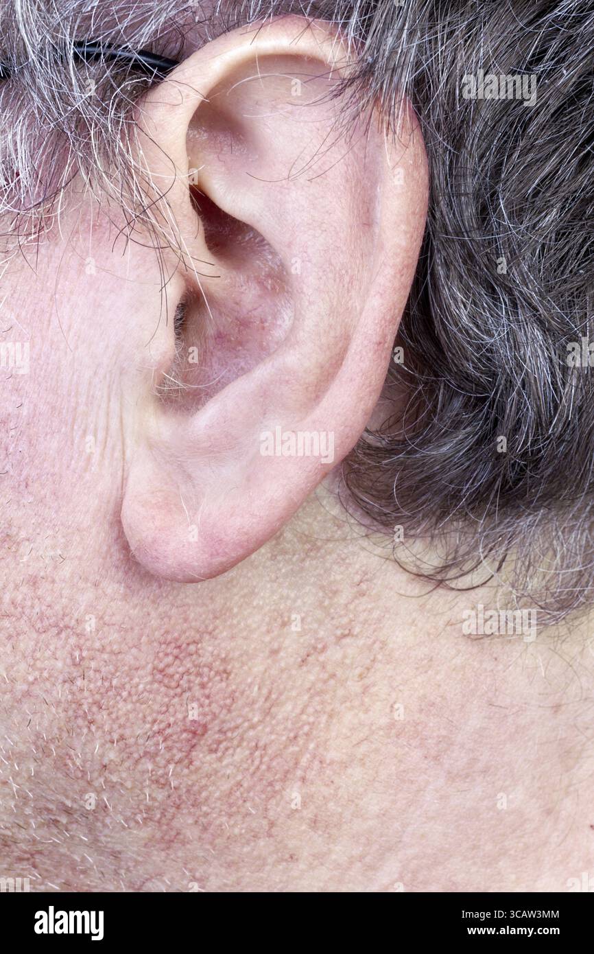 Haarige Ohr der ältere Mann Nahaufnahme. Graues Haar, die Haut ist mit Poren und Blutgefäße bedeckt. Selektiven Fokus Stockfoto