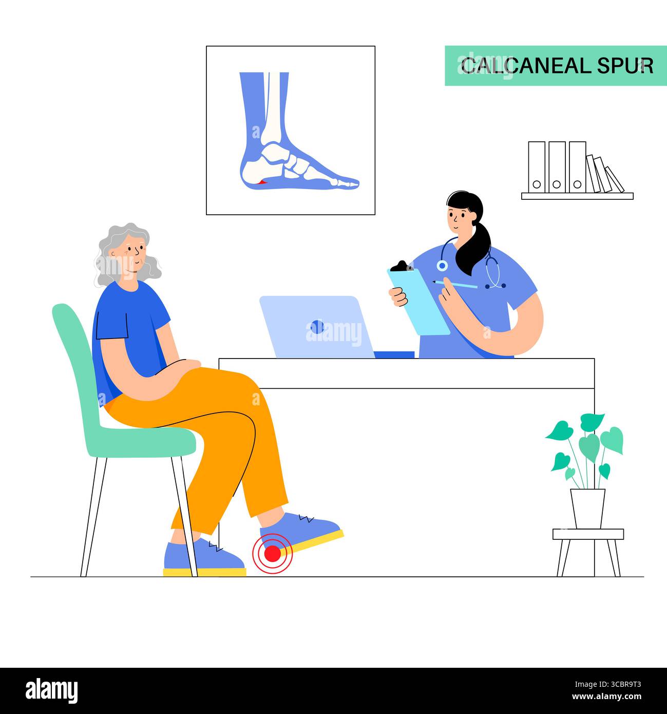 Abbildung eines Fersensporns. Dies ist ein knöchernes Wachstum, das sich am Fersenbein (Calcaneus) entwickeln kann. Viele Menschen mit Fersensporn haben keine Schmerzen, andere können starke Schmerzen und Druckempfindlichkeit in der Ferse haben. Stockfoto