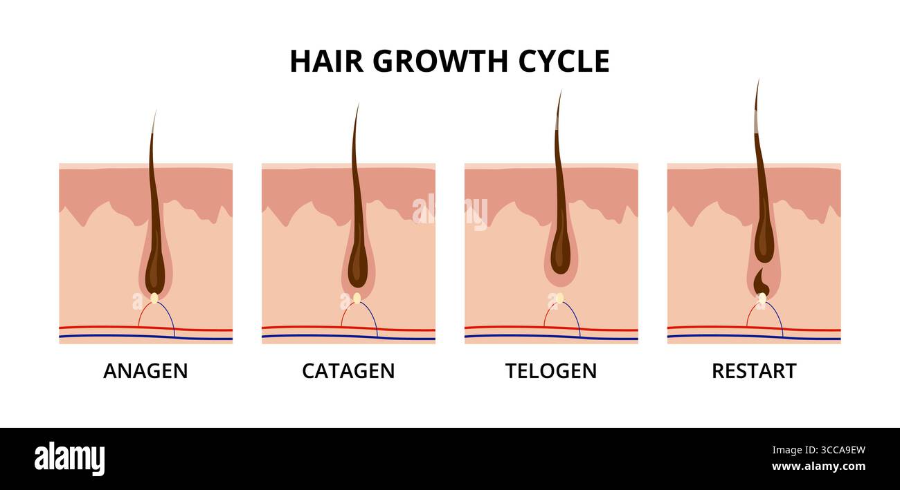 Haarwuchszyklus mit Anagen-, Catagen-, Telogen- und Neustartphasen Stock Vektor Haarwuchszyklus mit Anagen-, Catagen-, Telogen- und Neustartphasen Stock Vektor