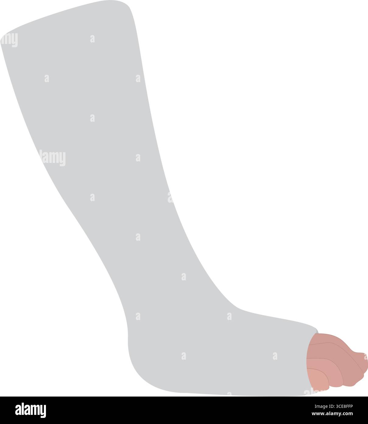 Gebrochenes Bein in Gips gegossener medizinischer Illustration Stock Vektor