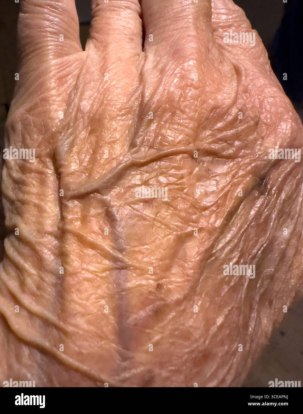 Vains zeigt sich in einer alten männlichen Hand. Stockfoto
