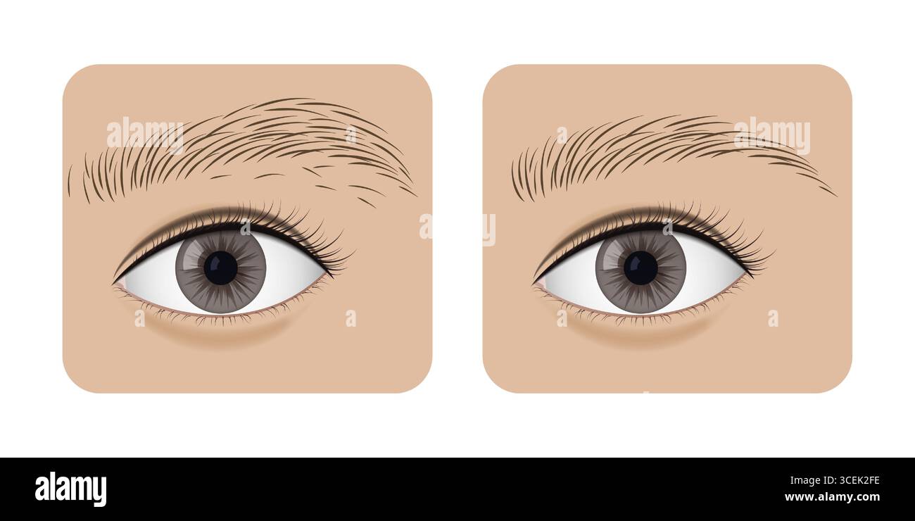 Augenbrauenzupfverfahren, das die Transformation von natürlichen Augenbrauen zu professionell gestylten Augenbrauen unterstreicht und den entscheidenden Unterschied verdeutlicht Stock Vektor
