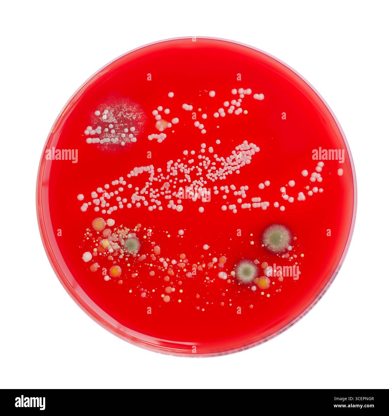 Bakterien- und Schimmelpilzkolonien, die aus der Raumluft auf Blut-Schafagar gewachsen sind, Foto, das die mikrobielle Vielfalt und Luftkontamination zeigt. Stockfoto