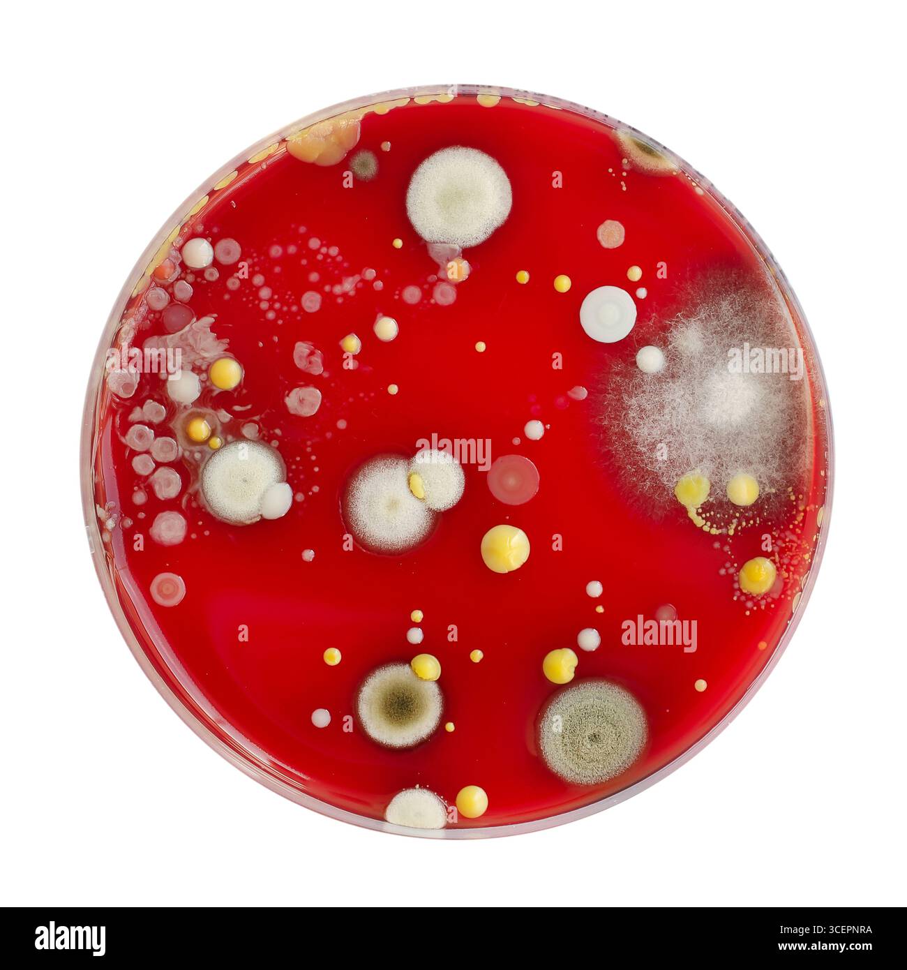 Bakterien- und Schimmelpilzkolonien, die aus der Raumluft auf Blut-Schafagar gewachsen sind, Foto, das die mikrobielle Vielfalt und Luftkontamination zeigt. Stockfoto