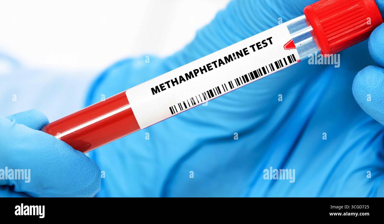 Der Methamphetamin-Test erkennt speziell die Verwendung von Methamphetamin, einem starken Stimulans. Stockfoto