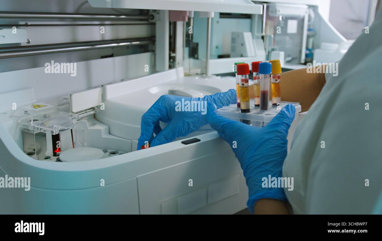 Ein Labortechniker in Handschuhen behandelt Blutproben, die in Röhrchen zur Analyse in einer medizinischen Einrichtung aufbewahrt werden. Stockfoto