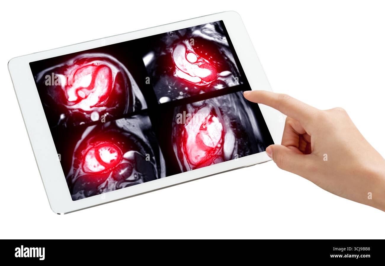 Futuristischer MRA-Herzscan auf Tablet mit Handzeigefunktion, die KI-gesteuerte Gesundheitsversorgung, fortschrittliche Radiologie und moderne Diagnosetechnologie für repräsentiert Stockfoto