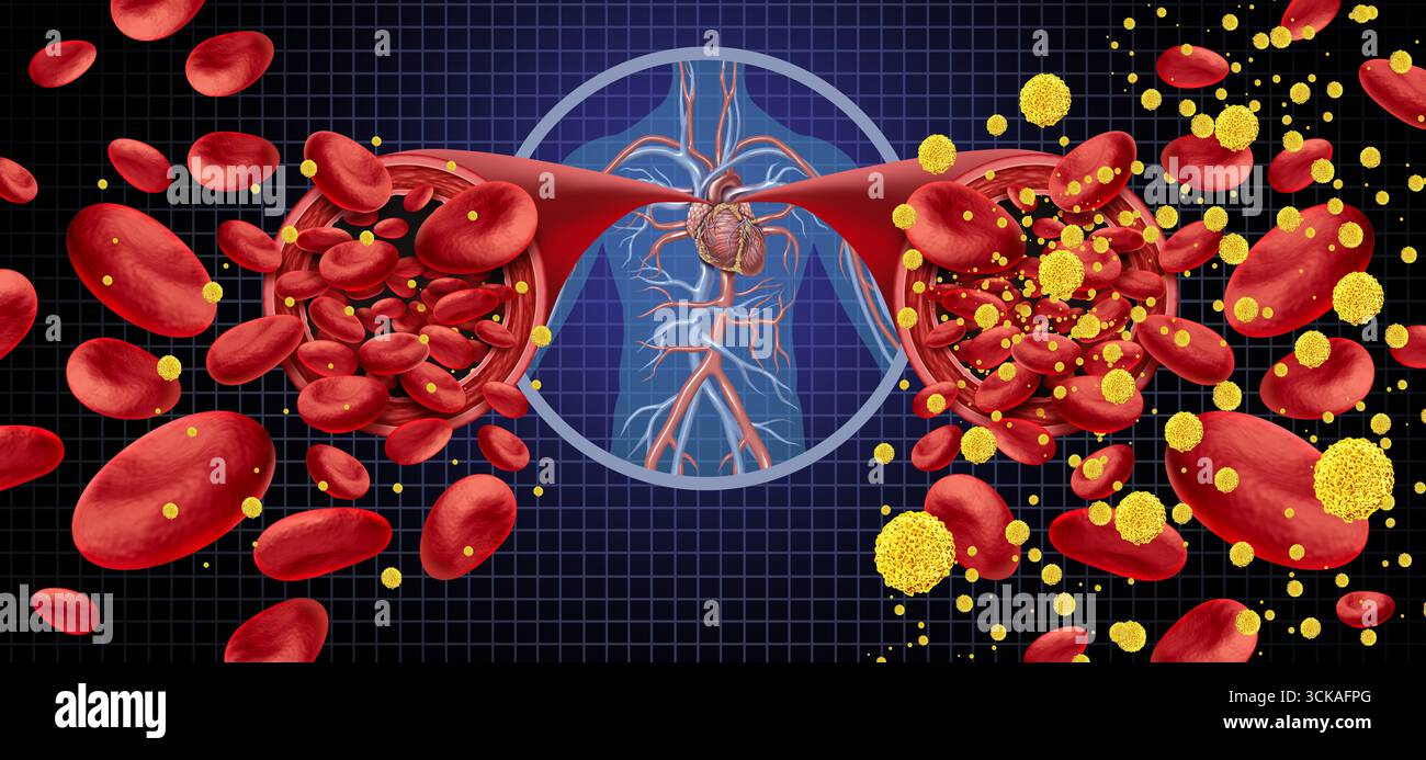 Diabetes-Symptome und diabetischer Blutzucker als Symbol für Hypoglykämie und Hyperglykämie oder normaler Glukosespiegel als Symbol für niedrigen oder hohen Blut Stockfoto