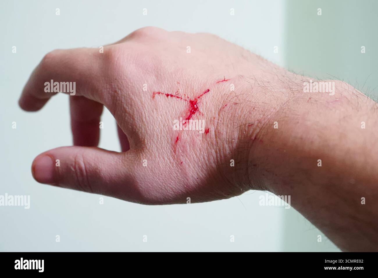 Hand mit frischen Schnitten, Kratzern und Blut durch Unfall oder Haustierattacken Stockfoto