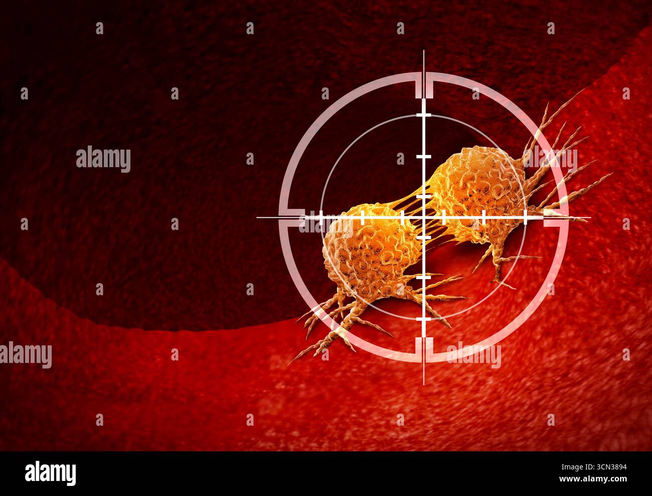 Onkologie medizinische Wissenschaft Krebsbekämpfung und bösartige Tumoren mit chirurgischer Entfernung oder Strahlenbehandlung zur Beseitigung von Krebszellen als Symbol für Stockfoto