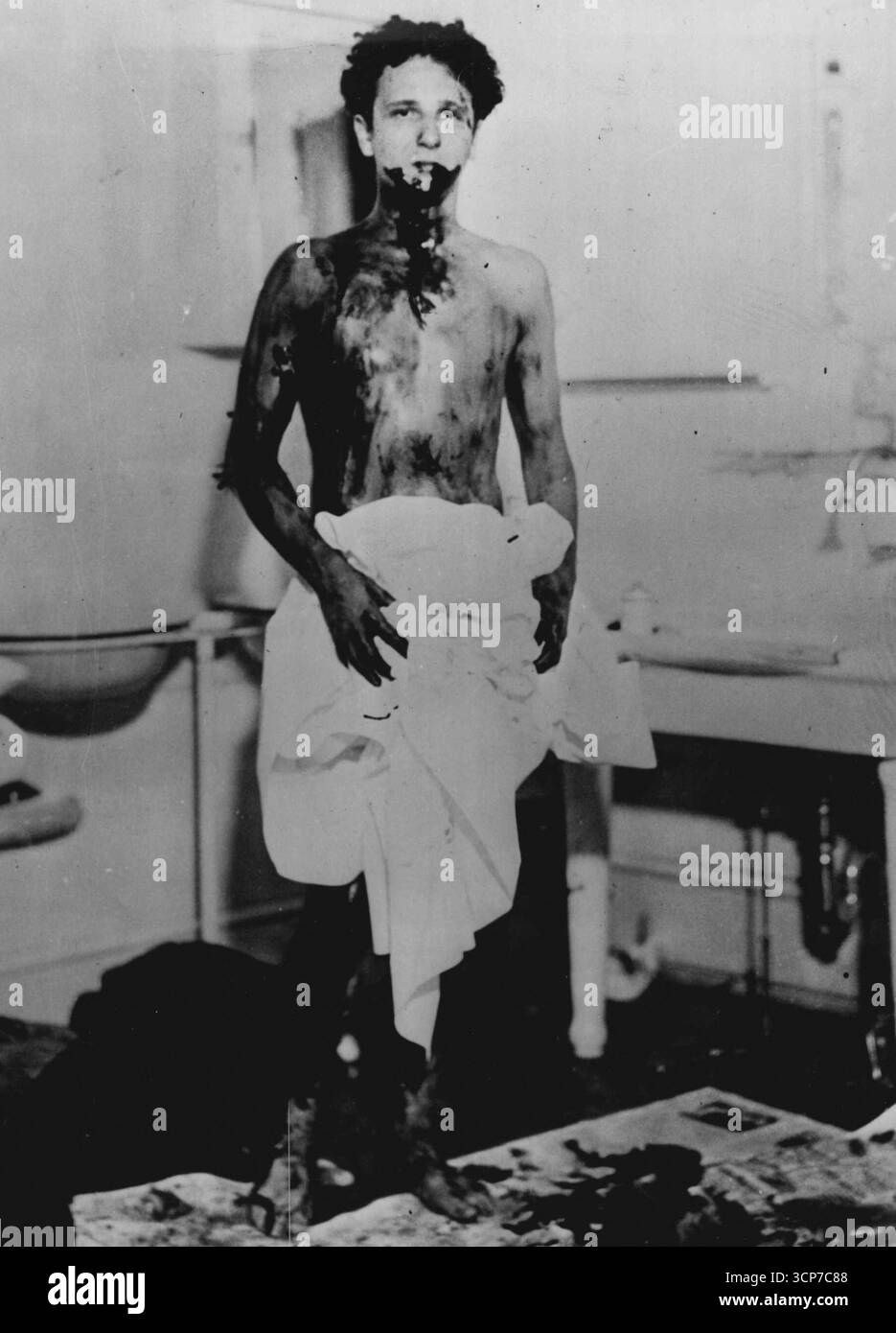 Kolumnist ist geteert und gefiedert – Graf Igor Cassini, Kolumnist der Gesellschaft, als er kurz nach seiner Entführung aus dem Warrenton Country Club im Fauquier County Hospital erschien. Er wurde von fünf Männern angegriffen, die ihn in einem Auto-Mobil auf eine einsame Straße brachten, etwa zehn Meilen von hier entfernt, wo sie ihn zehn Meilen von Teer weggeworfen und seinen Körper gefiedert haben. Juni 1939. (Foto von Wide World Photo). Stockfoto