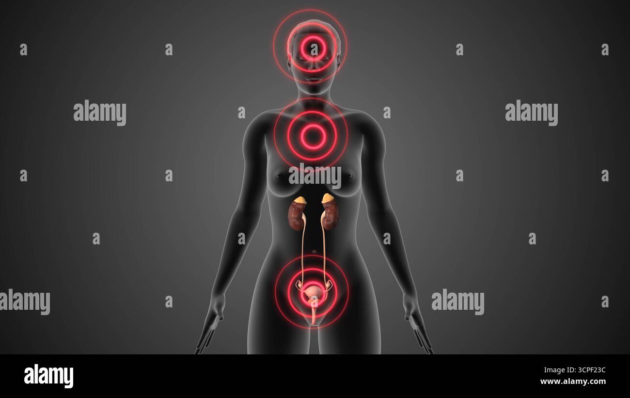 Menopausale Ubergangsstörung Des Körpers Stockfoto