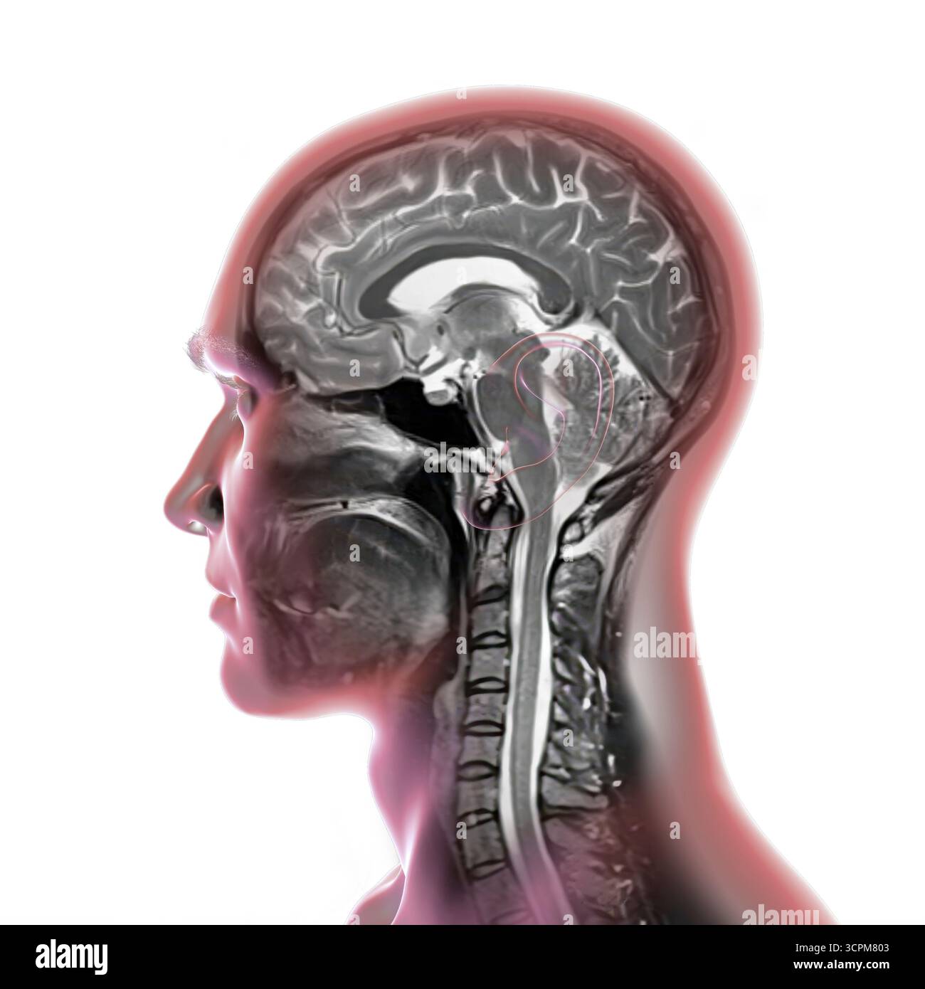 Abbildung einer farbigen Magnetresonanztomographie (MRT) des Gehirns und Halses, die die Anatomie des Zentralnervensystems und die Halswirbelsäule zeigt. Stockfoto