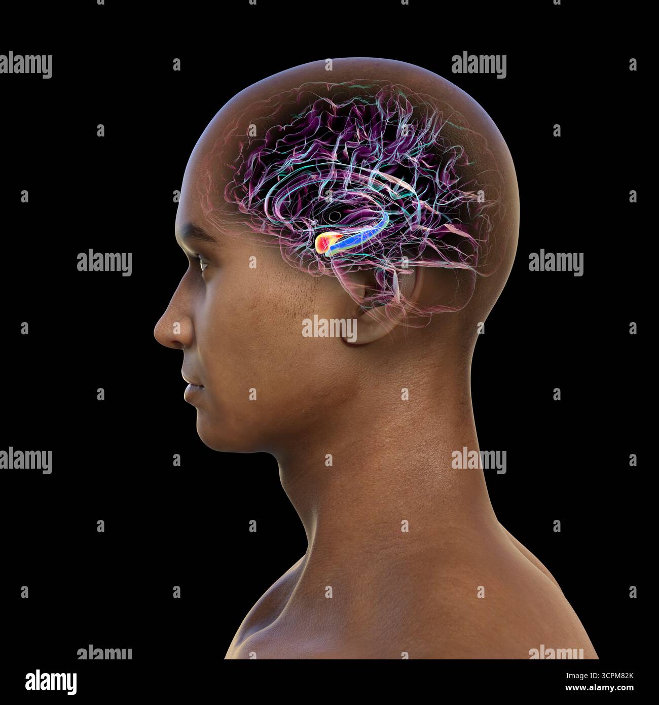 Abbildung eines menschlichen Hirnmittelschnitts mit hervorgehobener Amygdala (rot) und Hippocampus (blau). Dies sind Schlüsselregionen, die von Alzheimer-Erkrankungen betroffen sind Stockfoto