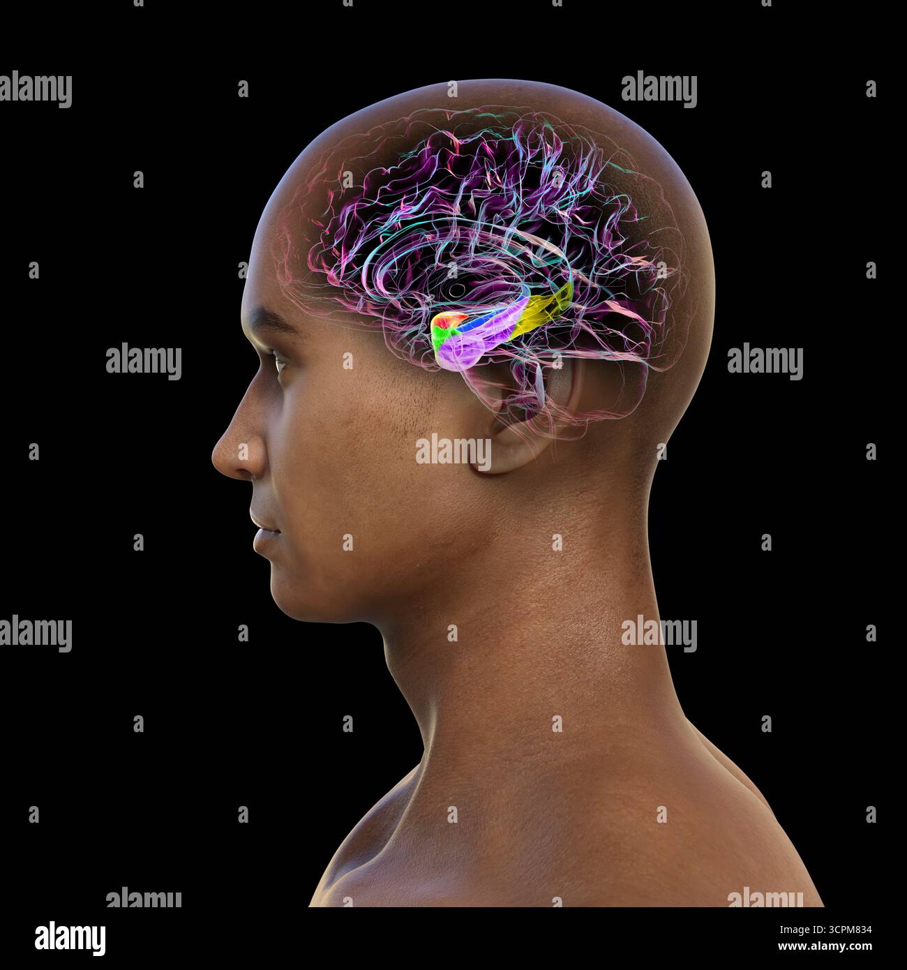 Darstellung eines menschlichen Hirnmittelschnitts mit hervorgehobener Amygdala (rot), Hippocampus (blau), parahippocampalem Gyrus und assoziierten Kortices: Perirhin Stockfoto