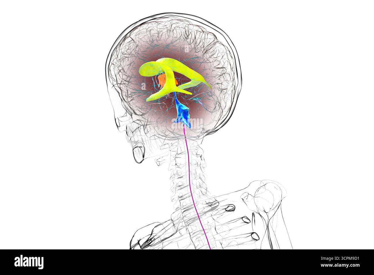 Abbildung des menschlichen Gehirns mit farbigen Ventrikeln: Lateral (gelb), dritter (orange), vierter (blau), interventrikuläres Foramen (grün), cerebral Stockfoto