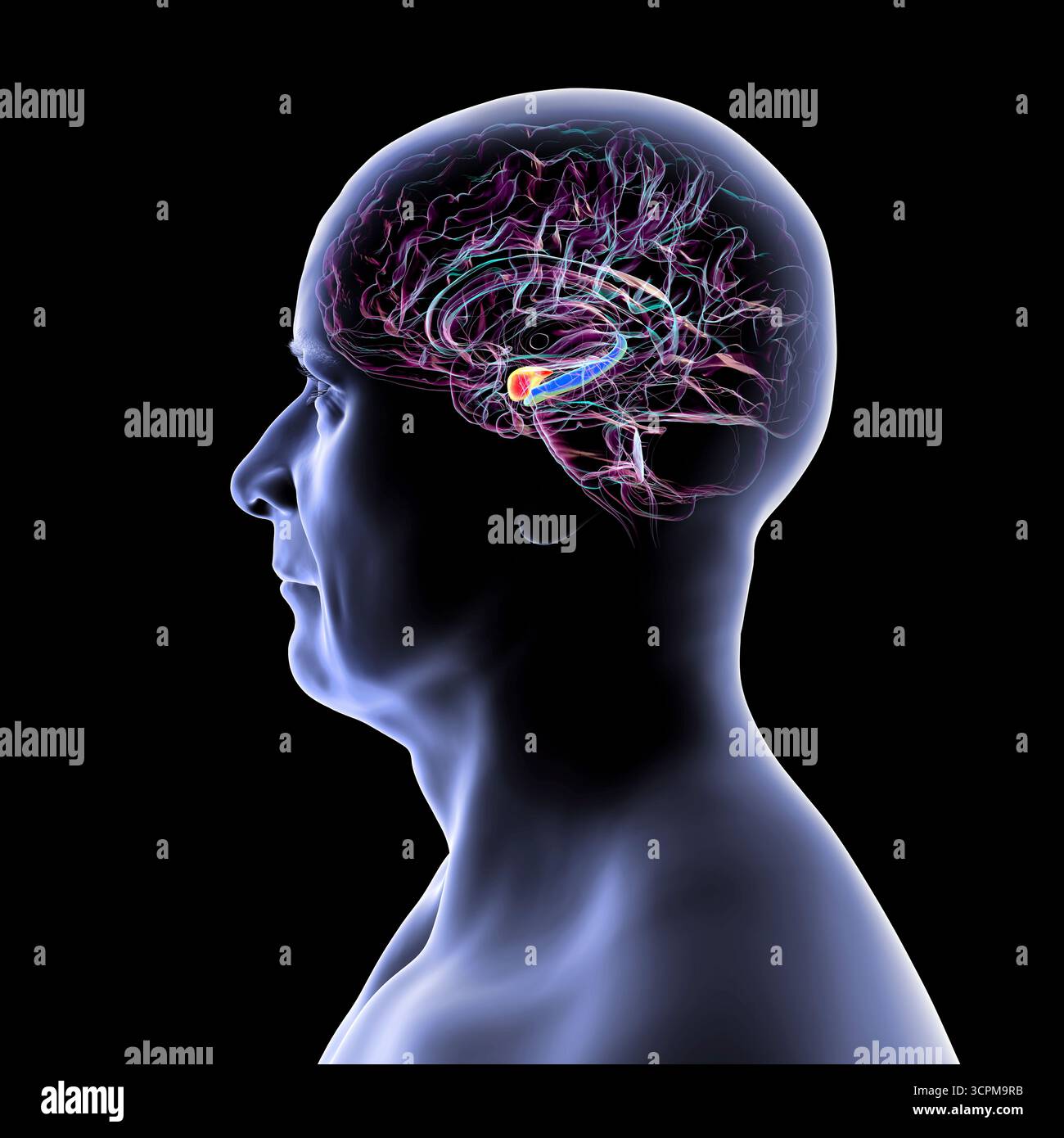 Abbildung eines menschlichen Hirnmittelschnitts mit hervorgehobener Amygdala (rot) und Hippocampus (blau). Dies sind Schlüsselregionen, die von Alzheimer-Erkrankungen betroffen sind Stockfoto