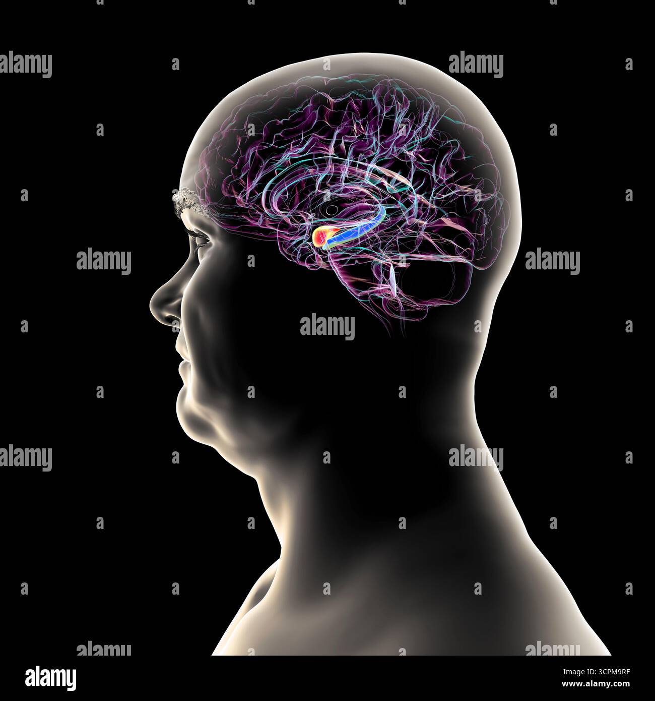 Abbildung eines menschlichen Hirnmittelschnitts mit hervorgehobener Amygdala (rot) und Hippocampus (blau). Dies sind Schlüsselregionen, die von Alzheimer-Erkrankungen betroffen sind Stockfoto