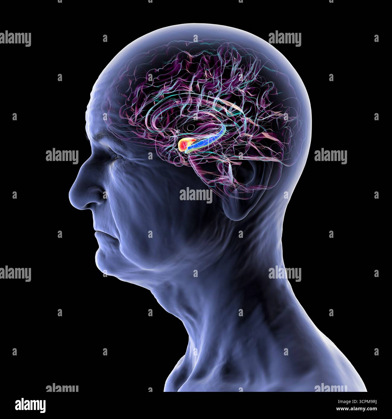 Illustration eines menschlichen Hirnmittelschnitts bei einem älteren Mann mit hervorgehobener Amygdala (rot) und Hippocampus (blau). Dies sind wichtige Regionen, die in Al betroffen sind Stockfoto