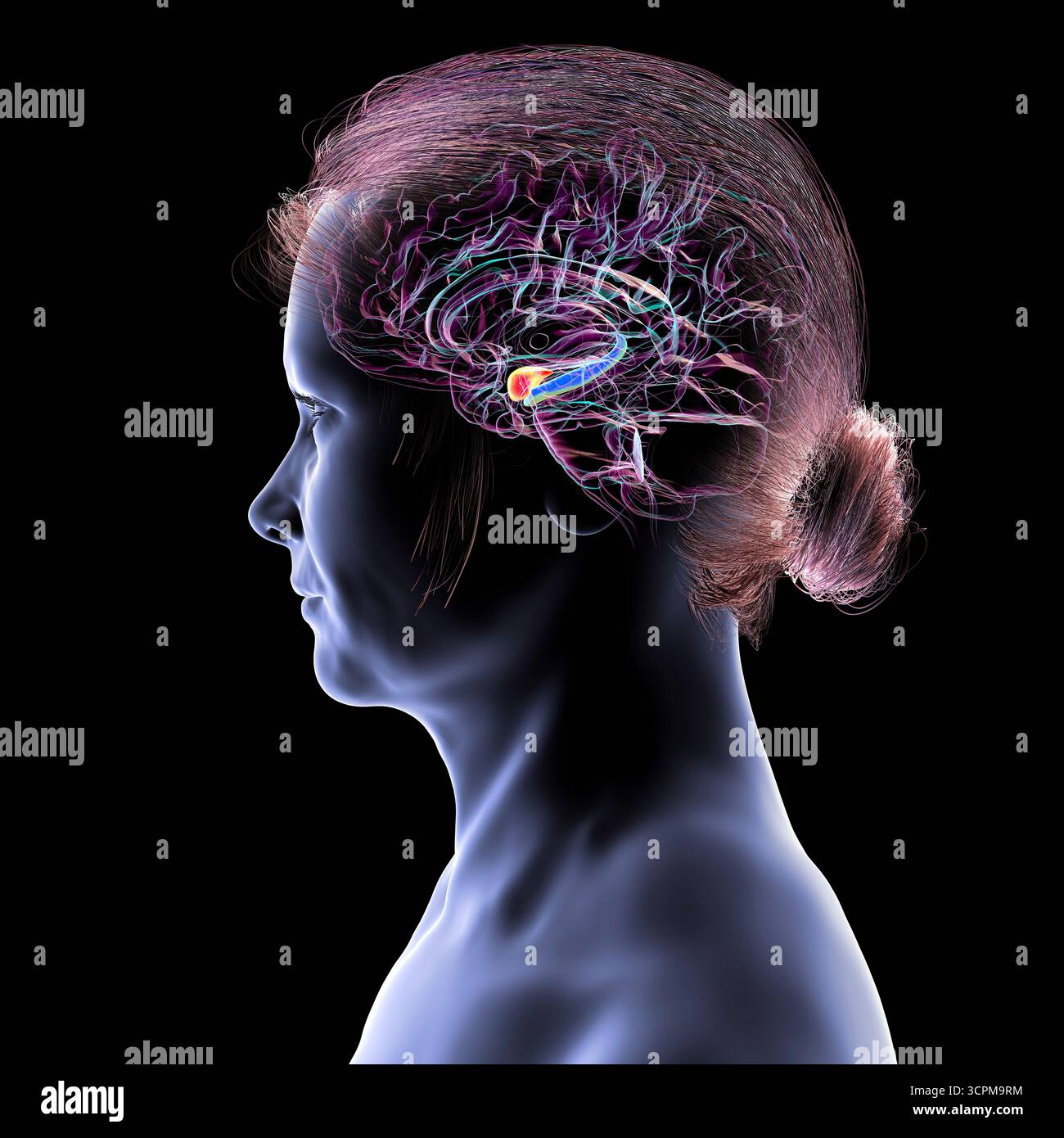 Abbildung eines menschlichen Hirnmittelschnitts mit hervorgehobener Amygdala (rot) und Hippocampus (blau). Dies sind Schlüsselregionen, die von Alzheimer-Erkrankungen betroffen sind Stockfoto