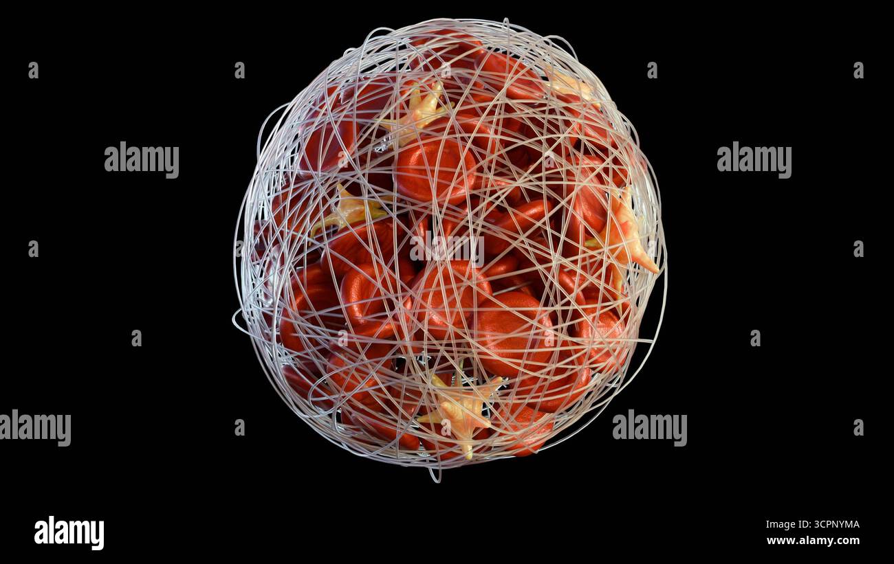 Das 3D-Bild der Thrombusbildung in einem Blutgefäß Stockfoto