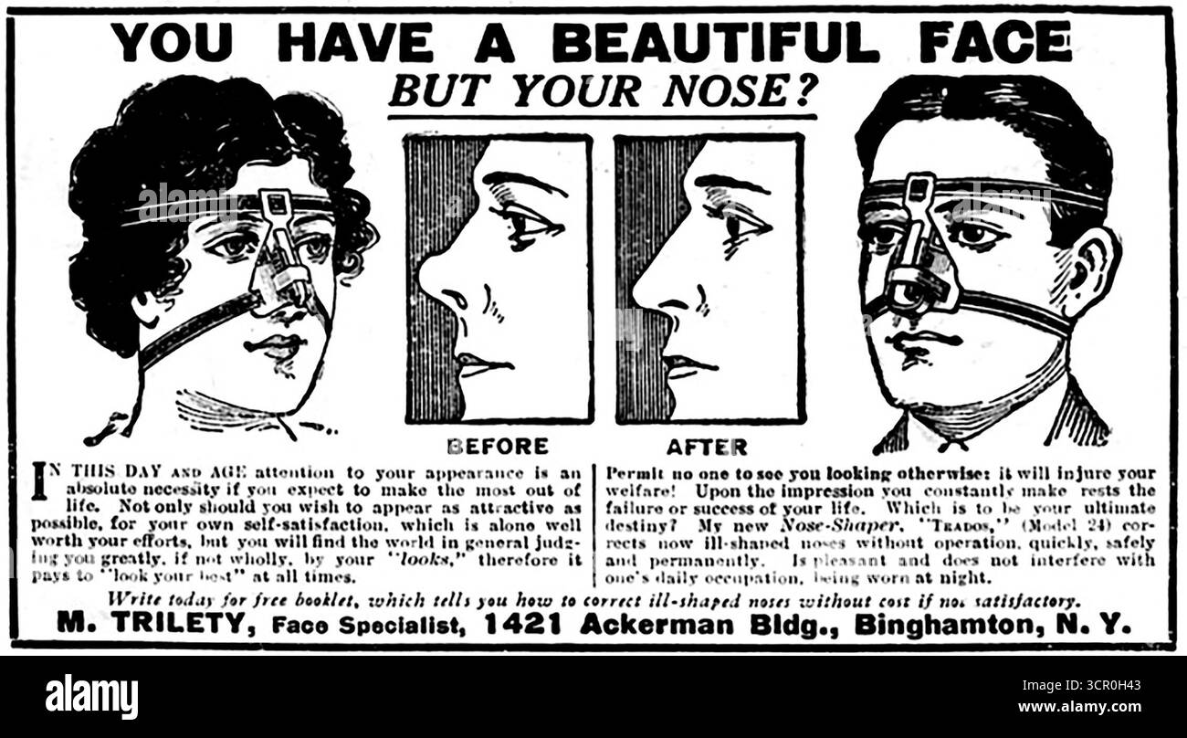 1916 M. Trilety Face Specialist Correct Nasengurt Ad Stockfoto