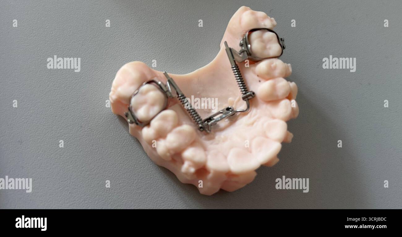 Expander brace -Fotos und -Bildmaterial in hoher Auflösung – Alamy