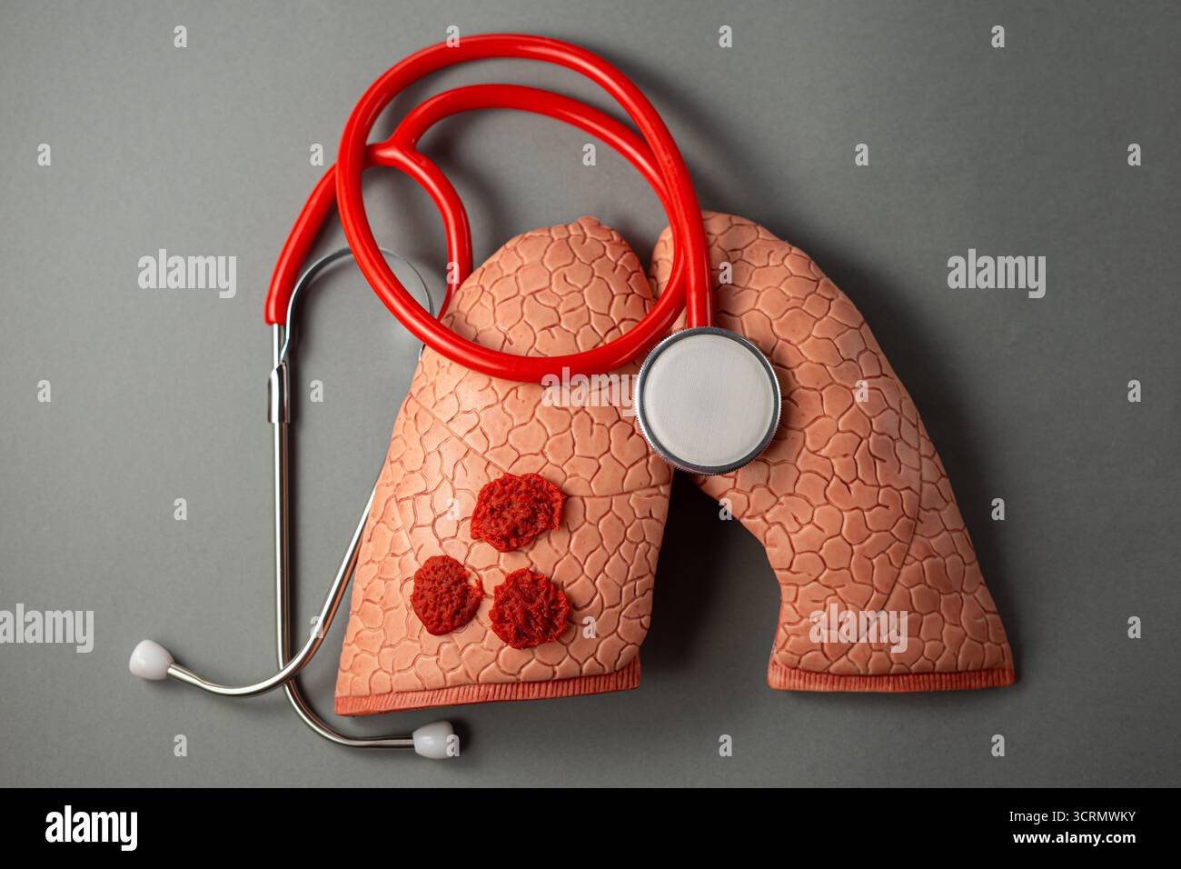 Welttuberkulosetag. Draufsicht der menschlichen Lunge und des medizinischen Stethoskops, Kopierraum Stockfoto