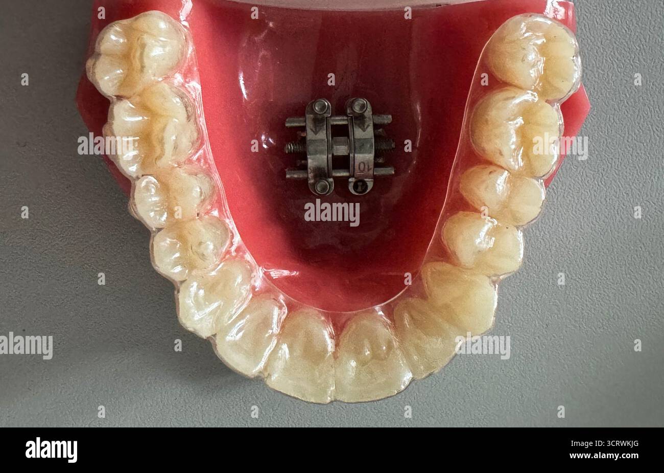 Expander brace -Fotos und -Bildmaterial in hoher Auflösung – Alamy