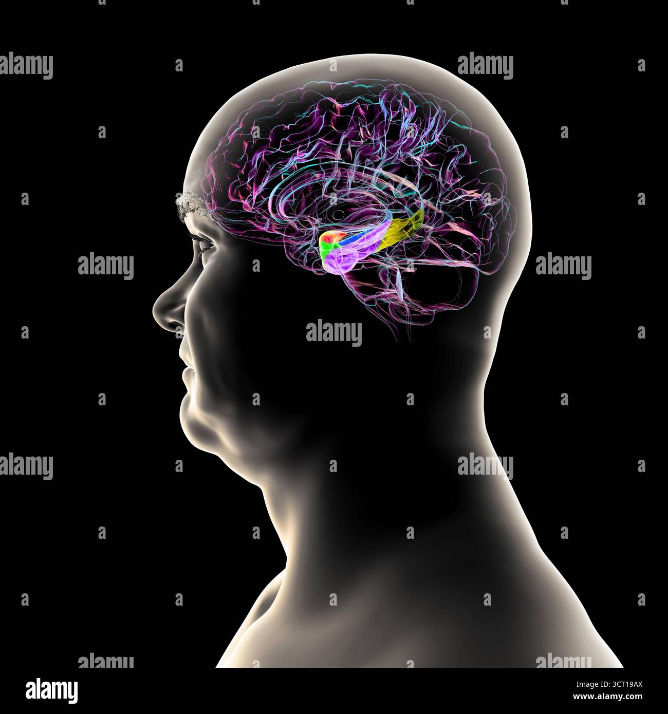 Abbildung eines menschlichen Hirnmittelschnitts mit hervorgehobener Amygdala (rot), Hippocampus (blau), parahippocampalem Gyrus und assoziierten Kortizen: Perirhinal (grün), entorhinal (violett) und parahippocampal (gelb). Stockfoto