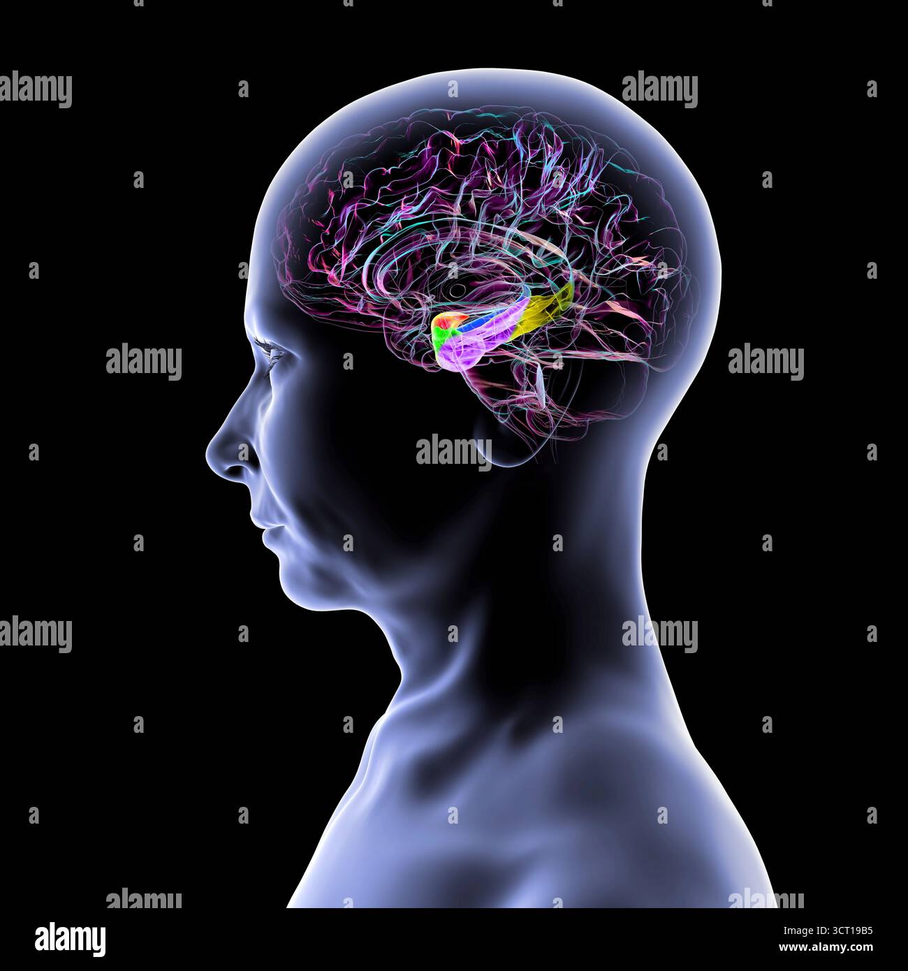 Abbildung eines menschlichen Hirnmittelschnitts mit hervorgehobener Amygdala (rot), Hippocampus (blau), parahippocampalem Gyrus und assoziierten Kortizen: Perirhinal (grün), entorhinal (violett) und parahippocampal (gelb). Stockfoto