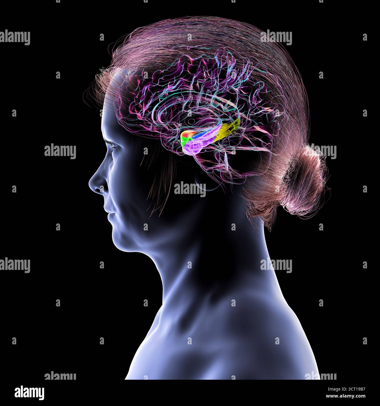 Abbildung eines menschlichen Hirnmittelschnitts mit hervorgehobener Amygdala (rot), Hippocampus (blau), parahippocampalem Gyrus und assoziierten Kortizen: Perirhinal (grün), entorhinal (violett) und parahippocampal (gelb). Stockfoto